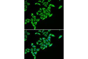 Immunofluorescence (IF) image for anti-Dihydrolipoyl Transacetylase (DLAT) antibody (ABIN1980304) (DLAT Antikörper)