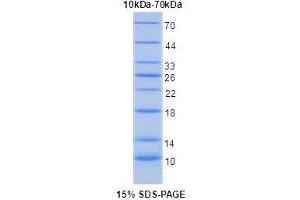 Image no. 2 for Interleukin 5 Receptor, alpha (IL5RA) protein (ABIN6306054) (IL5RA Protein)