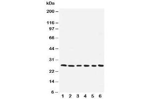 Western blot testing of ARC antibody and human samples 1:  SMMC-7721 (NOL3 Antikörper  (AA 91-106))
