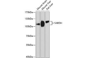 Western blot analysis of extracts of various cell lines, using SARDH Antibody (ABIN6128753, ABIN6147379, ABIN6147380 and ABIN6225034) at 1:3000 dilution. (SARDH Antikörper  (AA 300-560))