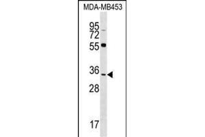 FKBP6 Antibody (C-term) (ABIN1536953 and ABIN2848611) western blot analysis in MDA-M cell line lysates (35 μg/lane). (FKBP6 Antikörper  (C-Term))