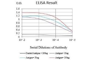 Black line: Control Antigen (100 ng),Purple line: Antigen (10 ng), Blue line: Antigen (50 ng), Red line:Antigen (100 ng) (Ki-67 Antikörper  (AA 1160-1493))