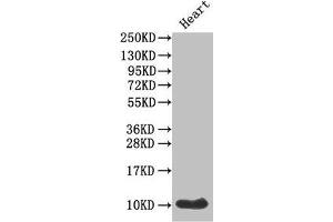 Western Blot Positive WB detected in: Mouse heart tissue All lanes: IAPP antibody at 1 μg/mL Secondary Goat polyclonal to rabbit IgG at 1/50000 dilution Predicted band size: 10 kDa Observed band size: 10 kDa (Amylin/DAP Antikörper  (AA 34-70))