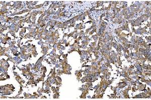 IHC analysis of HGS using anti-HGS antibody (ABIN7601206). (HGS Antikörper  (AA 3-777))
