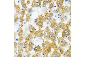 Immunohistochemistry (Paraffin-embedded Sections) (IHC (p)) image for anti-GABA(A) Receptor-Associated Protein (GABARAP) (AA 1-100) antibody (ABIN6140872)
