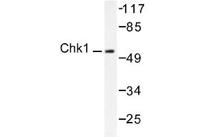 Image no. 1 for anti-Checkpoint Kinase 1 (CHEK1) antibody (ABIN265347) (CHEK1 Antikörper)