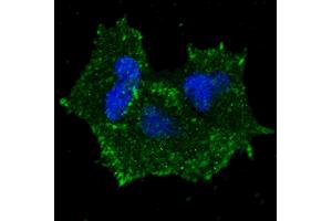 Fluorescent confocal image of MCF7 cells stained with phospho-ERBB2- antibody. (ErbB2/Her2 Antikörper  (pTyr1196))
