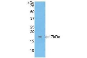 Detection of Recombinant ADAMTS7, Rat using Polyclonal Antibody to A Disintegrin And Metalloproteinase With Thrombospondin 7 (ADAMTS7)