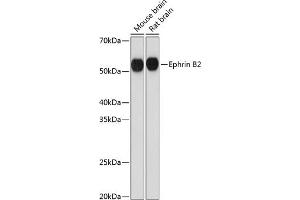 Western blot analysis of extracts of various cell lines, using Ephrin B2 Rabbit mAb (ABIN7266978) at 1:1000 dilution. (Ephrin B2 Antikörper)