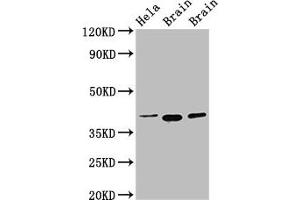 Western Blot Positive WB detected in: Hela whole cell lysate, Rat brain tissue, Mouse brain tissue All lanes: ERGIC2 antibody at 2. (ERGIC2 Antikörper  (AA 55-310))