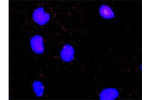 Proximity Ligation Assay (PLA) image for anti-MAP Kinase Interacting serine/threonine Kinase 2 (MKNK2) (AA 1-158) antibody (ABIN516167)