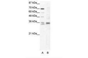 Image no. 1 for anti-SRY (Sex Determining Region Y)-Box 12 (SOX12) (C-Term) antibody (ABIN202223) (SOX12 Antikörper  (C-Term))