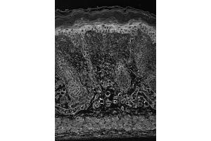 Image no. 3 for anti-Hypoxia Inducible Factor 1, alpha Subunit (Basic Helix-Loop-Helix Transcription Factor) (HIF1A) (AA 329-530) antibody (ABIN863097)