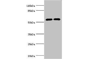 Western blot All lanes: CYP2E1 antibody at 12 μg/mL Lane 1: Jurkat whole cell lysate Lane 2: Mouse liver tissue Secondary Goat polyclonal to rabbit IgG at 1/10000 dilution Predicted band size: 57 kDa Observed band size: 57 kDa (CYP2E1 Antikörper  (AA 49-288))