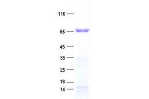 ZNF677 Protein (His tag)