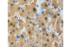 IHC-P analysis of liver tissuev, with DAB staining.