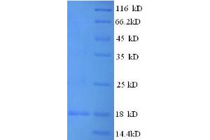 SDS-PAGE (SDS) image for Filaggrin (FLG) (AA 3838-4061), (partial) protein (His tag) (ABIN4986554) (Filaggrin Protein (FLG) (AA 3838-4061, partial) (His tag))