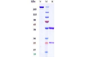 Anti-CB1 / CNR1 Reference Antibody (GFB-024) on SDS-PAGE under reducing (R) condition.