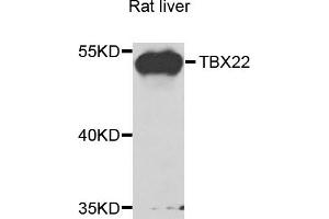 Western blot analysis of extracts of rat liver cells, using TBX22 antibody. (T-Box 22 Antikörper)