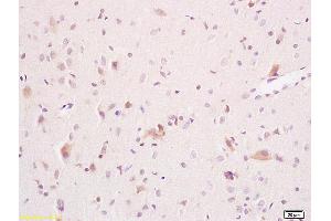 Formalin-fixed and paraffin embedded rat brain tissue labeled with Anti ARSA Polyclonal Antibody,Unconjugated (ABIN752428) at 1:200 followed by conjugation to the secondary antibody and DAB staining.