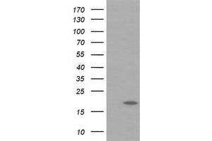 Image no. 5 for anti-Ubiquitin-Conjugating Enzyme E2G 2 (UBE2G2) antibody (ABIN1501632) (UBE2G2 Antikörper)