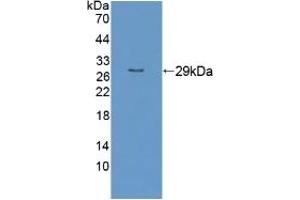 Detection of Recombinant RND1, Human using Polyclonal Antibody to Rho Family GTPase 1 (RND1) (RND1 Antikörper  (AA 1-229))