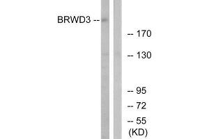 Western Blotting (WB) image for anti-Heat Shock 70kDa Protein 8 (HSPA8) (Internal Region) antibody (ABIN1852554) (Hsc70 Antikörper  (Internal Region))
