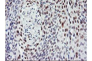 Immunohistochemistry (IHC) image for anti-BTB and CNC Homology 1, Basic Leucine Zipper Transcription Factor 1 (BACH1) antibody (ABIN1496803) (BACH1 Antikörper)