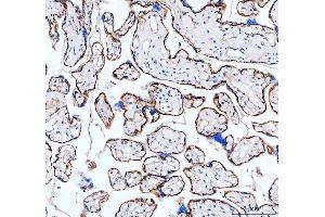 IHC analysis of ITGA5 using anti-ITGA5 antibody (ABIN5693202).