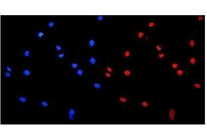 IF analysis of HnRNP A1 using anti-HnRNP A1 antibody (ABIN4886621). (HNRNPA1 Antikörper  (N-Term))