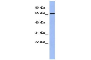 WB Suggested Anti-A1CF Antibody Titration:  0. (A1CF Antikörper  (N-Term))