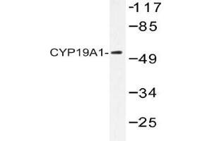 Western blot (WB) analysis of CYP19A1 Antibody in extracts from 293 cells. (Aromatase Antikörper)