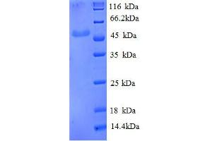 SDS-PAGE (SDS) image for Enolase 3 (Beta, Muscle) (ENO3) (AA 7-432), (partial) protein (His tag) (ABIN1046613)