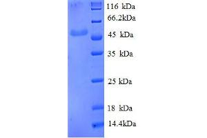 Enolase 3 (Beta, Muscle) (ENO3) (AA 7-432), (partial) protein (His tag)