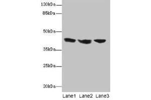 Western blot All lanes: IL2RG antibody at 12 μg/mL Lane 1: Jurkat whole cell lysate Lane 2: K562 whole cell lysate Lane 3: HL60 whole cell lysate Secondary Goat polyclonal to rabbit IgG at 1/10000 dilution Predicted band size: 43, 21 kDa Observed band size: 43 kDa (IL2RG Antikörper  (AA 75-230))
