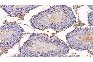 Immunohistochemistry (IHC) image for anti-Angiogenin (ANG) (AA 25-147) antibody (ABIN7430312)
