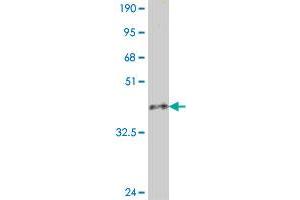 Western Blotting (WB) image for anti-Latent Transforming Growth Factor beta Binding Protein 1 (LTBP1) (AA 403-500) antibody (ABIN561694)
