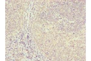 Immunohistochemistry of paraffin-embedded human tonsil tissue using ABIN7152411 at dilution of 1:100 (FBXO22 Antikörper  (AA 104-403))