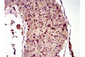 Immunohistochemical analysis of paraffin-embedded testis tissues using MAP1LC3A mouse mAb with DAB staining. (MAP1LC3A Antikörper  (AA 1-121))