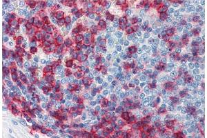 Immunohistochemistry (Paraffin-embedded Sections) (IHC (p)) image for anti-Sialophorin (SPN) antibody (ABIN2749028)