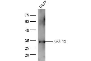 Human U937 lysates probed with Rabbit Anti-CD300A/C Polyclonal Antibody, Unconjugated  at 1:5000 for 90 min at 37˚C. (CD300A/ C (AA 20-70) Antikörper)