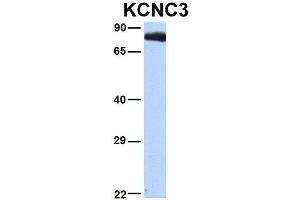 Western Blotting (WB) image for anti-Potassium Voltage-Gated Channel, Shaw-Related Subfamily, Member 3 (KCNC3) (Middle Region) antibody (ABIN2776169)