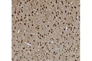 IHC analysis of GAP43 using anti-GAP43 antibody (ABIN7603111).