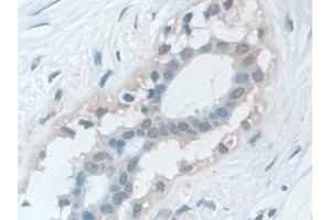 Immunohistochemistry (IHC) image for anti-Valosin Containing Protein (VCP) (AA 125-371) antibody (ABIN7440884)