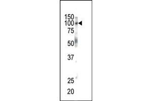 EPH Receptor B1 Antikörper  (C-Term)