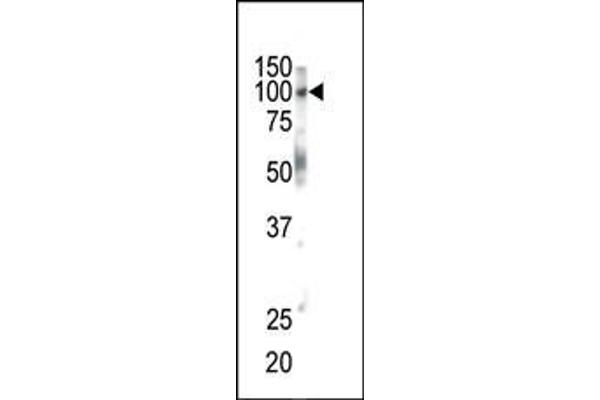 EPH Receptor B1 Antikörper  (C-Term)