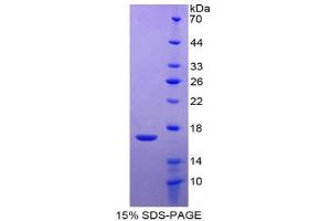 SDS-PAGE (SDS) image for Matrix Metallopeptidase 3 (Stromelysin 1, Progelatinase) (MMP3) (AA 363-477) protein (His tag) (ABIN2125818)
