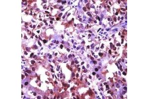 Immunohistochemistry (IHC) image for anti-Heat Shock Factor Protein 1 (HSF1) (AA 72-100) antibody (ABIN3031159)