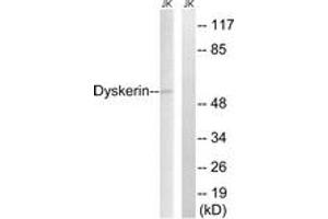 Western Blotting (WB) image for anti-Dyskeratosis Congenita 1, Dyskerin (DKC1) (AA 171-220) antibody (ABIN2889340) (DKC1 Antikörper  (AA 171-220))