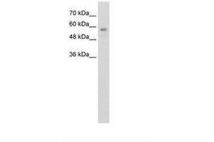 Image no. 1 for anti-RanBP-Type and C3HC4-Type Zinc Finger Containing 1 (RBCK1) (AA 181-230) antibody (ABIN203455)